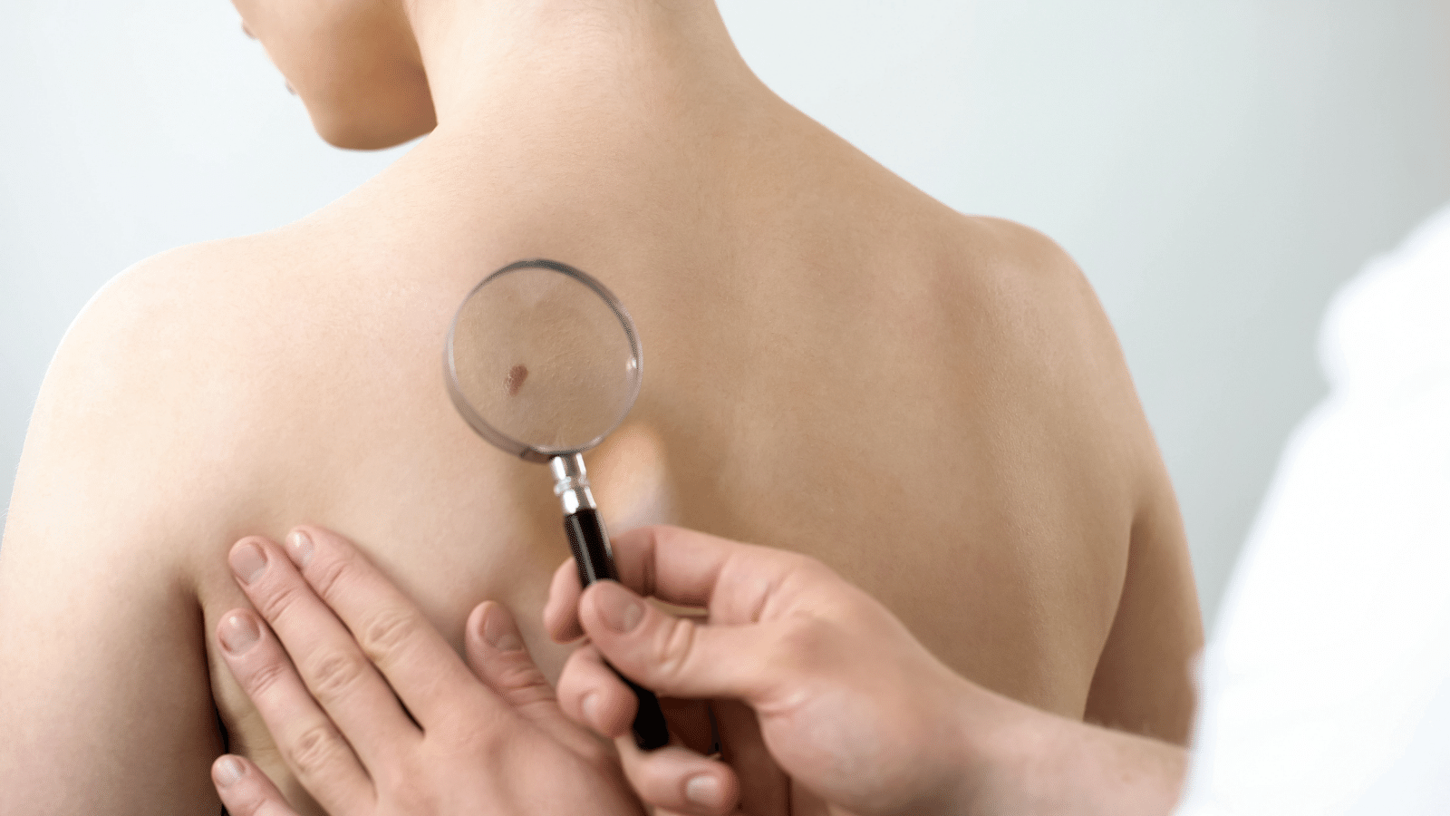 Skin Cancer Check
