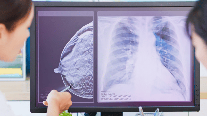 Two women looking at xrays